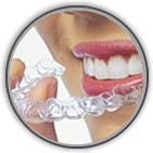 Invisalign Somerville